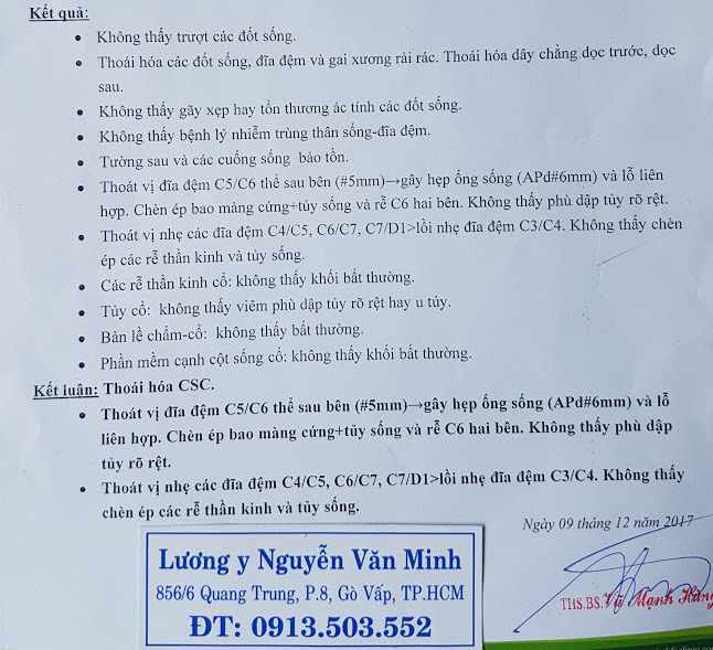 Chữa thoát vị đĩa đệm ngay tại nhà