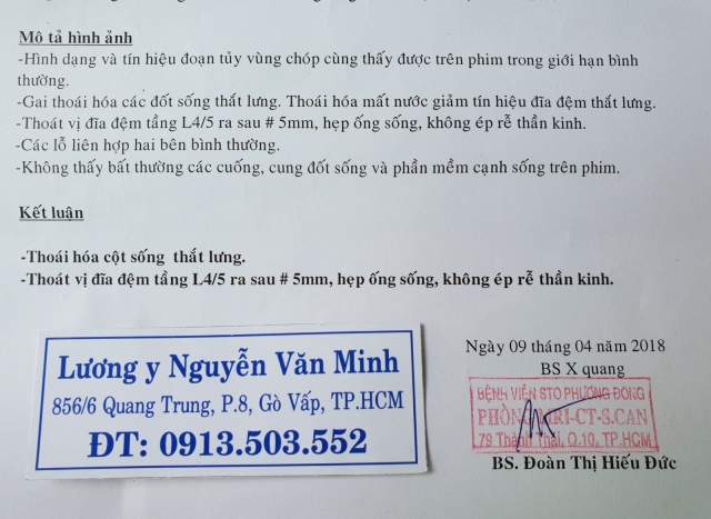 Thoát vị đĩa đệm + Thoái hóa cột sống thắt lưng - Uống thuốc gì.