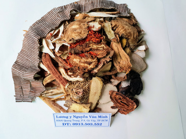 Bài thuốc chữa thoát vị đĩa đệm