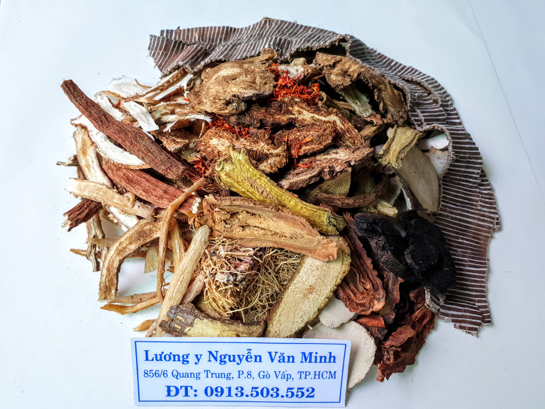 Thuốc đông y chữa thoát vị đĩa đệm