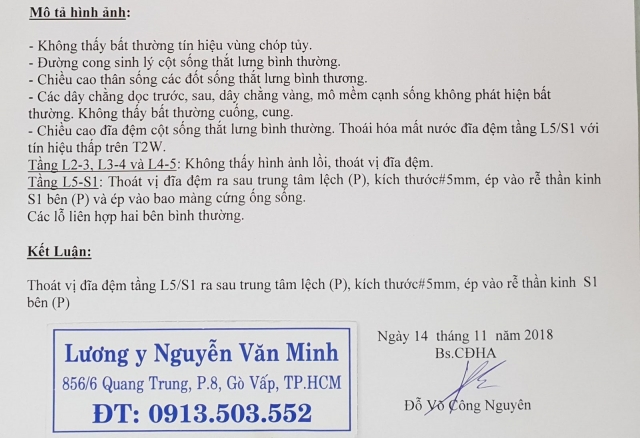 Thoát vị đĩa đệm do tập tạ