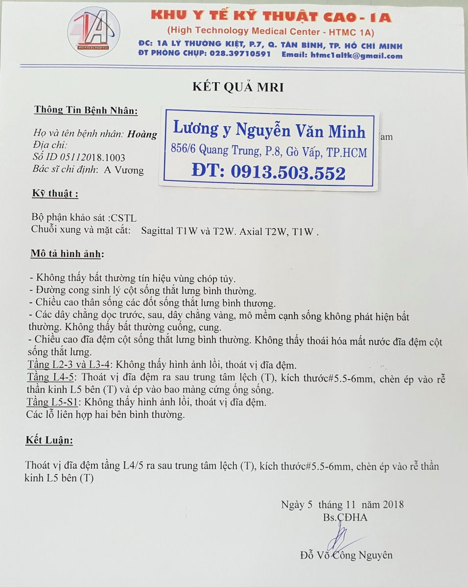 Thoát vị đĩa đệm cột sống lưng