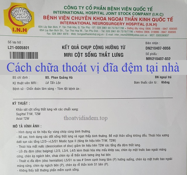 Cách chữa thoát vị đĩa đệm tại nhà