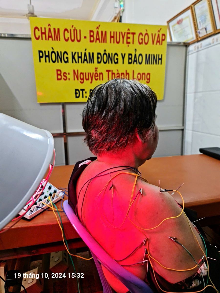 Hình ảnh châm cúu