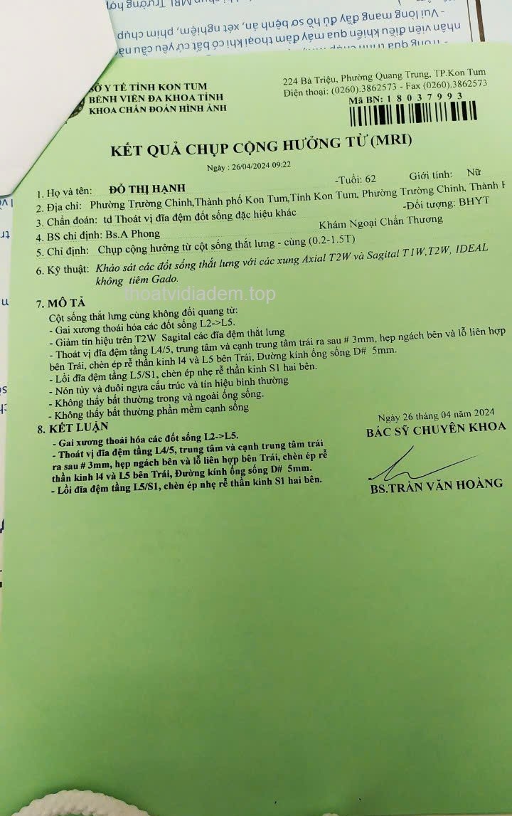 Chữa thoát vị đĩa đệm cho bác Hạnh ở Kon Tum
