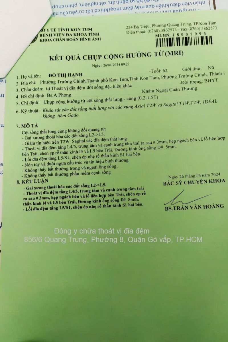 Thoat-vi-dia-dem-L4-L5