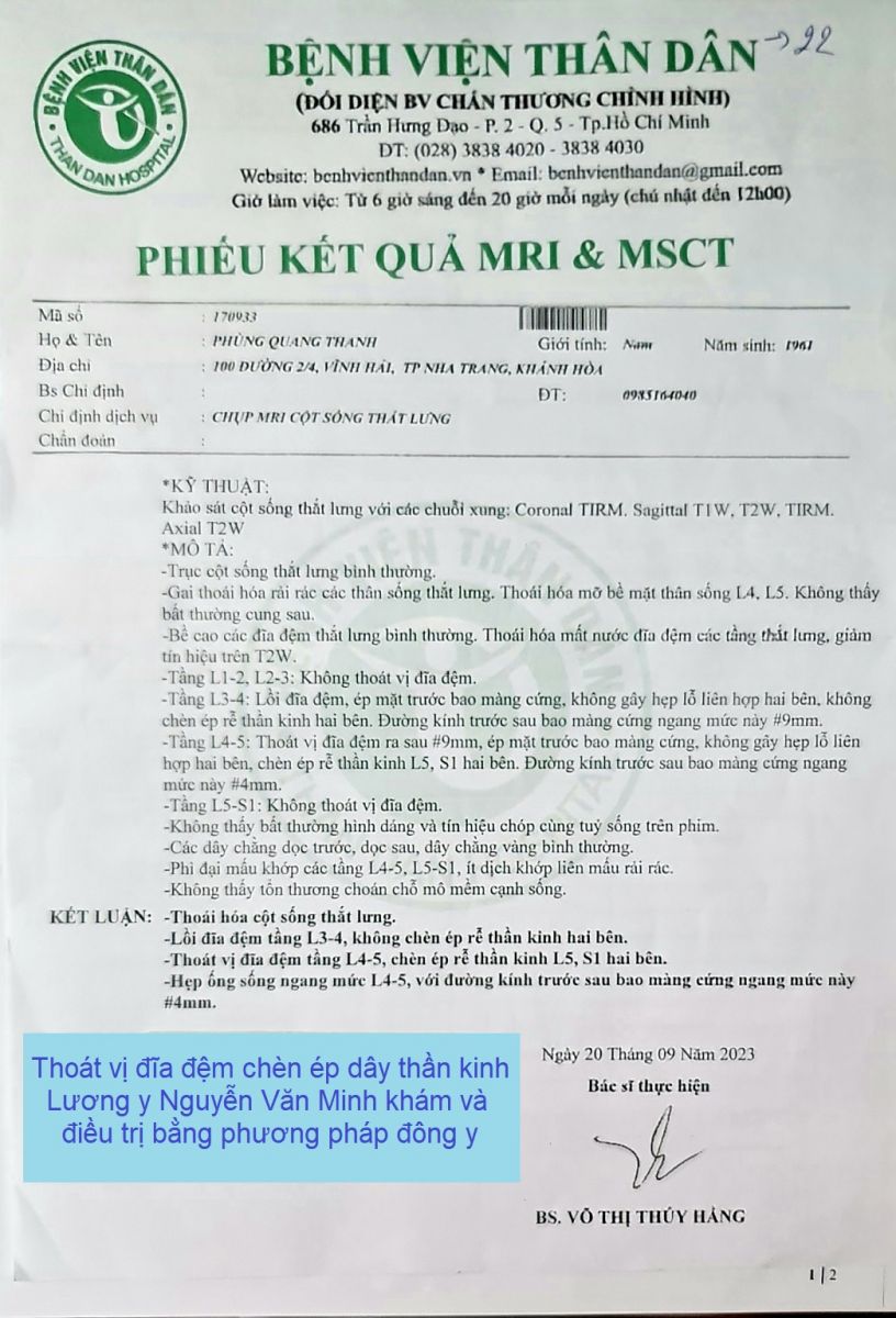 Thoat-vi-dia-dem-chen-ep-day-than-kinh