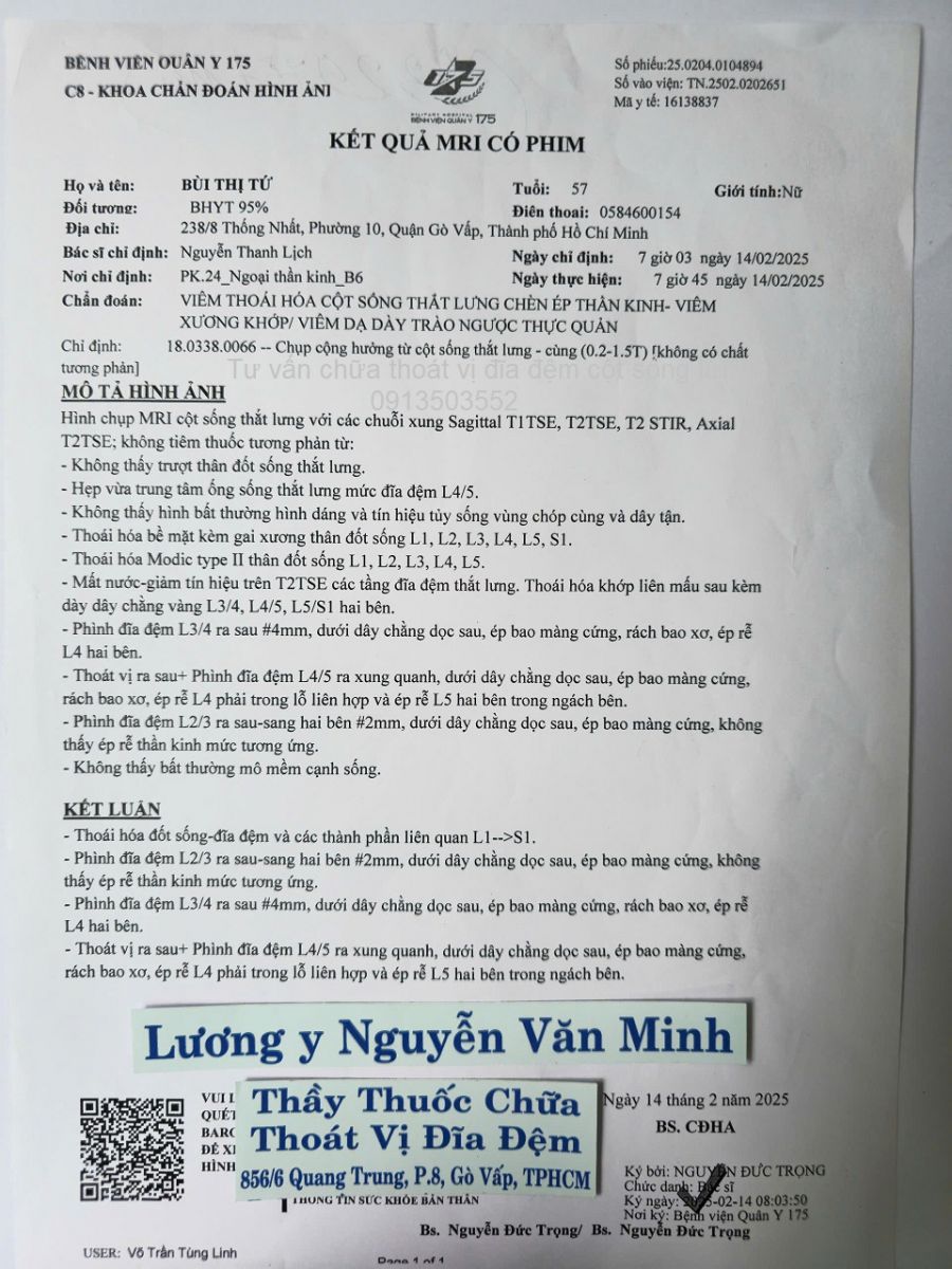 thoat-vi-dia-dem-cot-song-lung