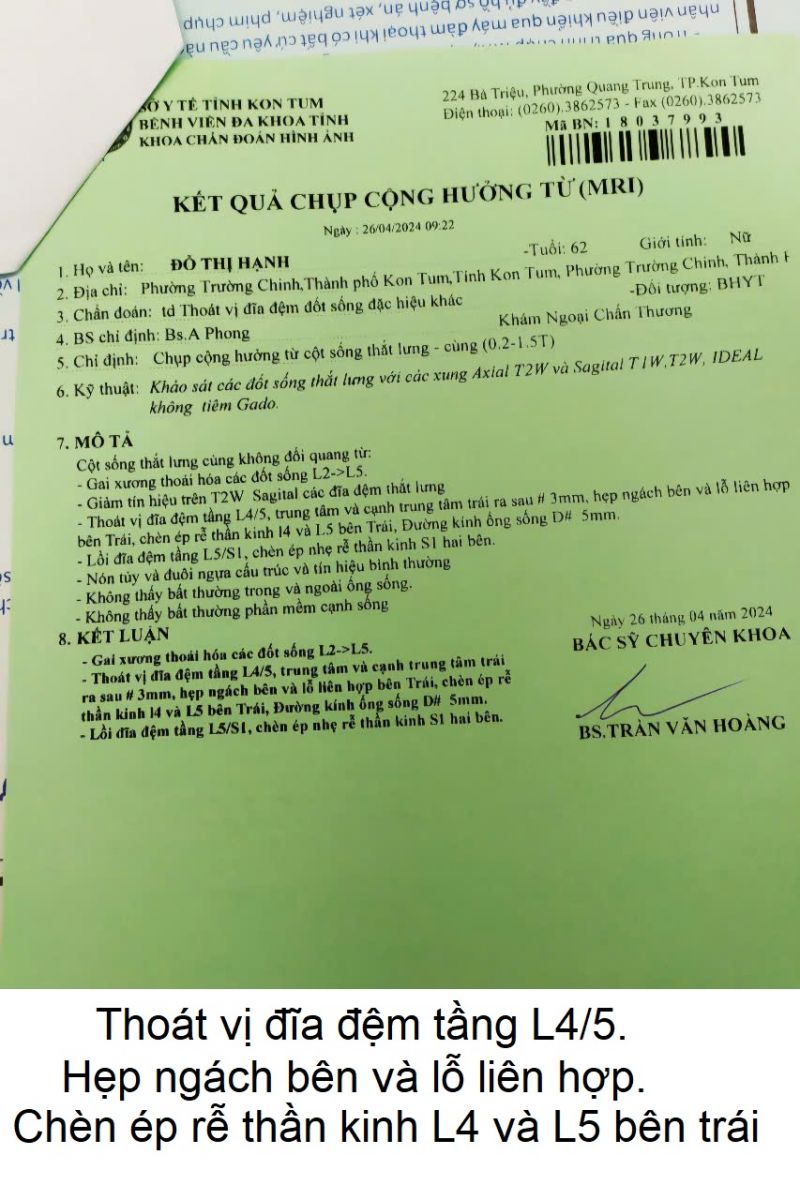 thoat-vi-dia-dem-cot-song