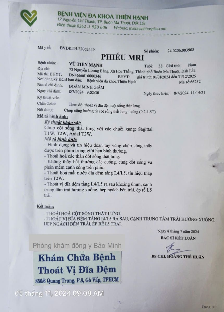 Thuoc-tri-thoat-vi-dia-dem