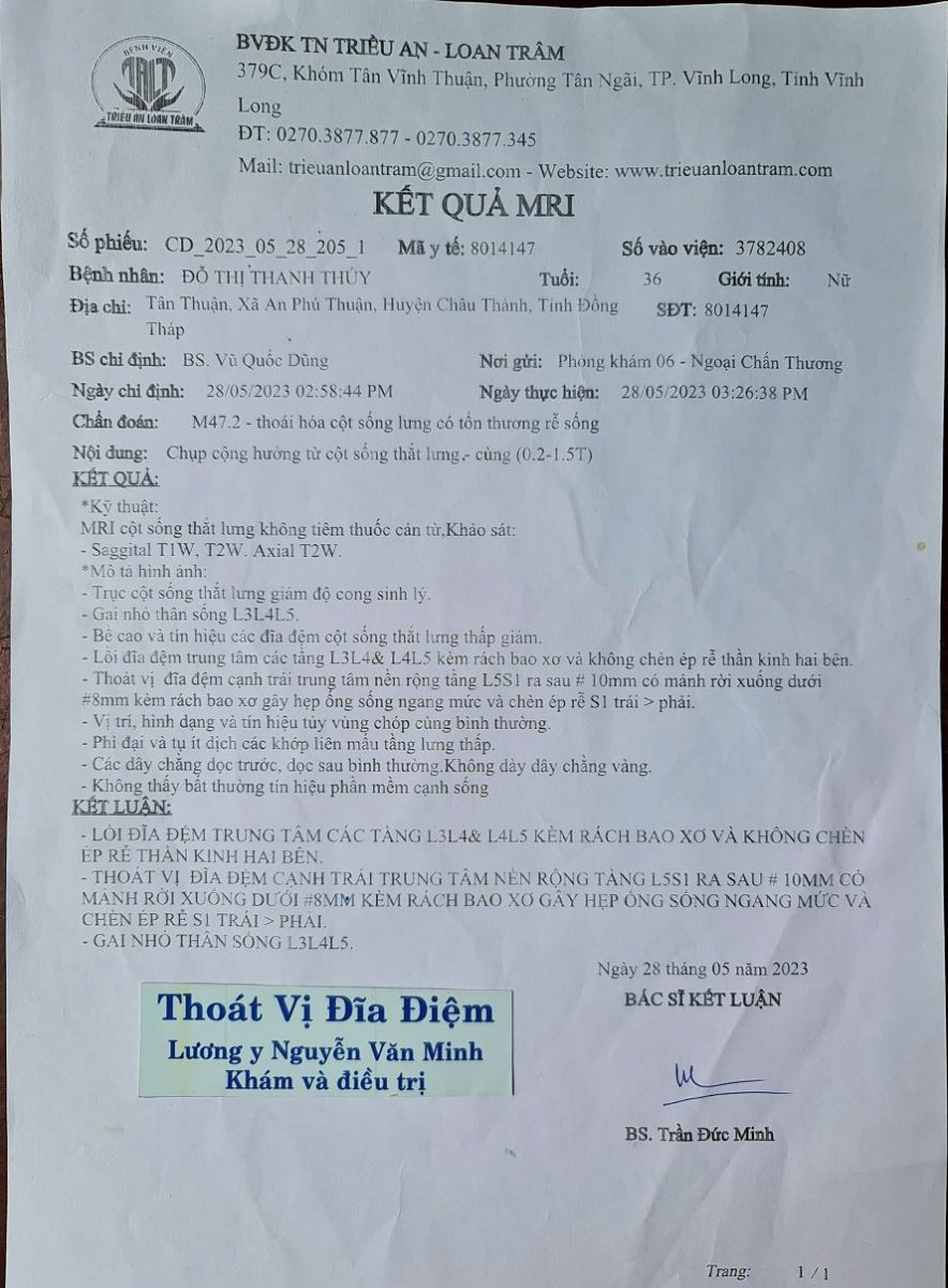 Thuoc-tri-thoat-vi-dia-dem