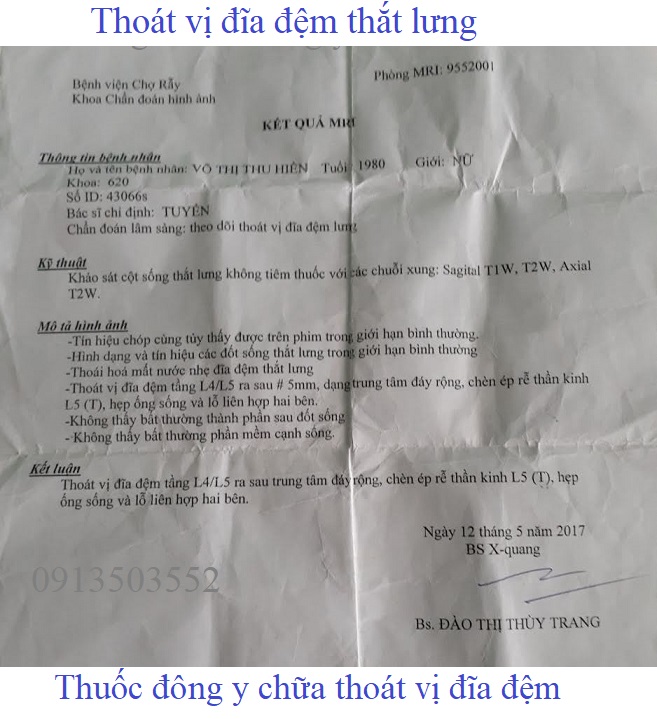 Thoát vị đĩa đệm thắt lưng