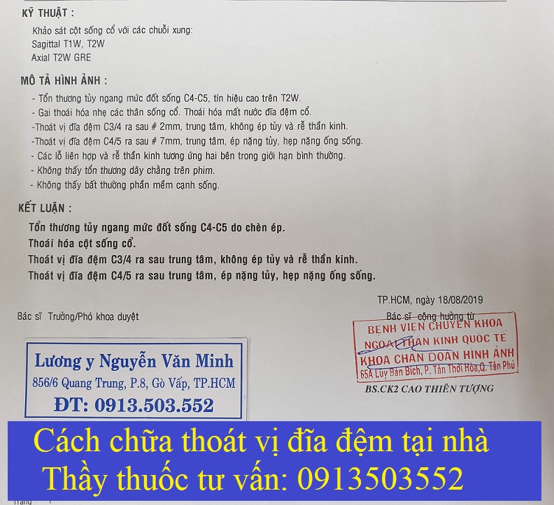 Thầy thuốc tư vấn cách chữa bệnh thoát vị đĩa đẹm tại nhà