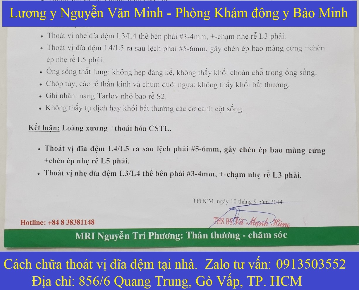 Cách chữa thoát vị đĩa đệm tại nhà