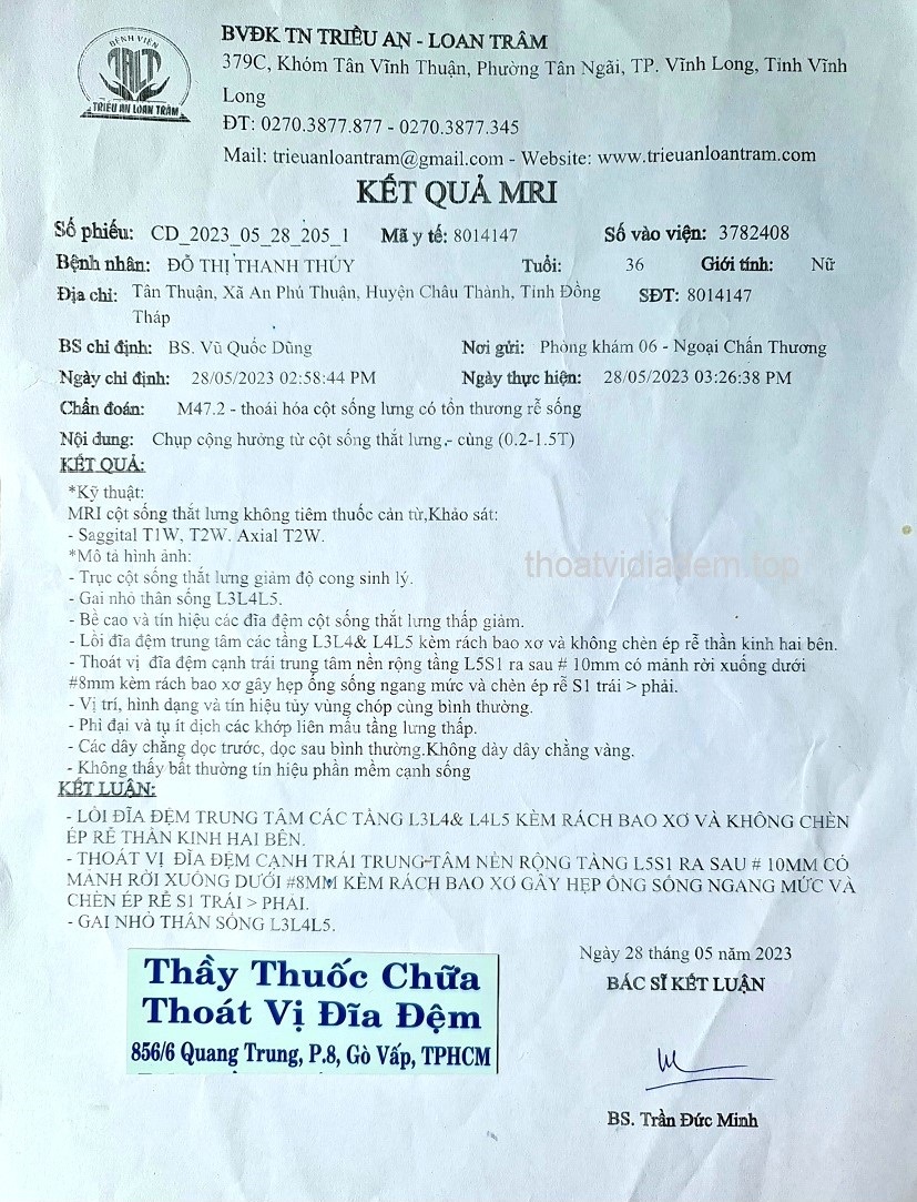 cach-chua-thoat-vi-dia-dem