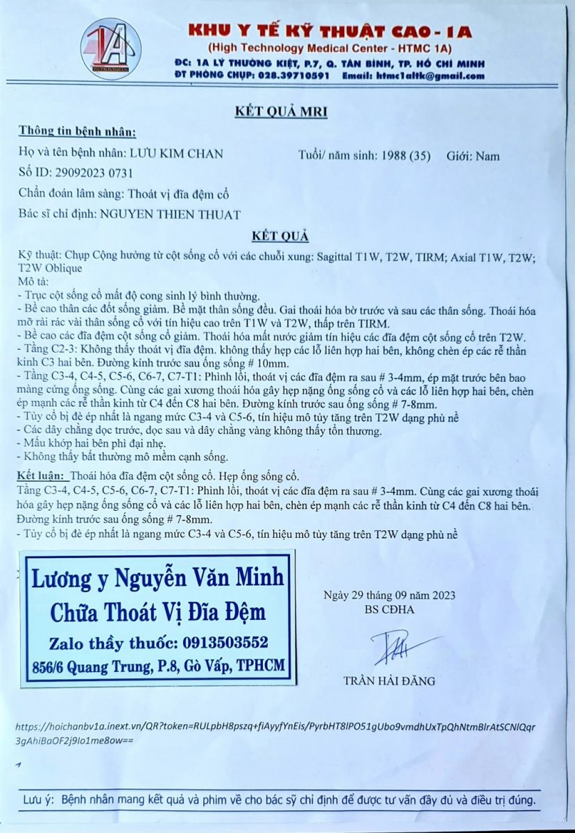 Chữa đau vai gáy, tê tay do thoát vị đĩa đệm cổ