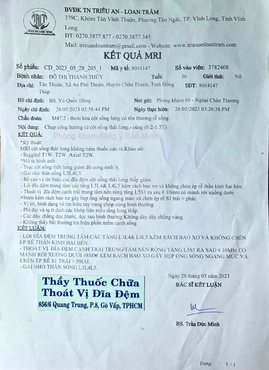 Chữa thoát vị đĩa đệm ở Đồng Tháp