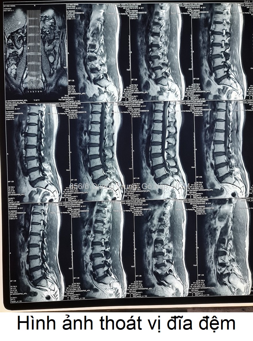 hinh-anh-thoat-vi-dia-dem